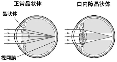 Ӧ1.png