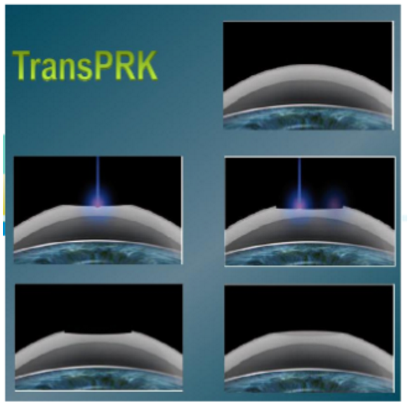 ޷ֹۿơаϣȾ3.png